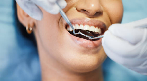 Best Emergency Broken Tooth Repair in Rexland Acres, CA