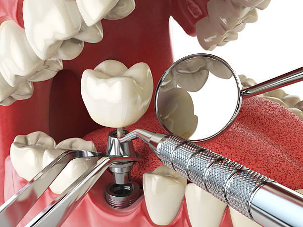 Best Emergency Dental Surgery in Rexland Acres, CA